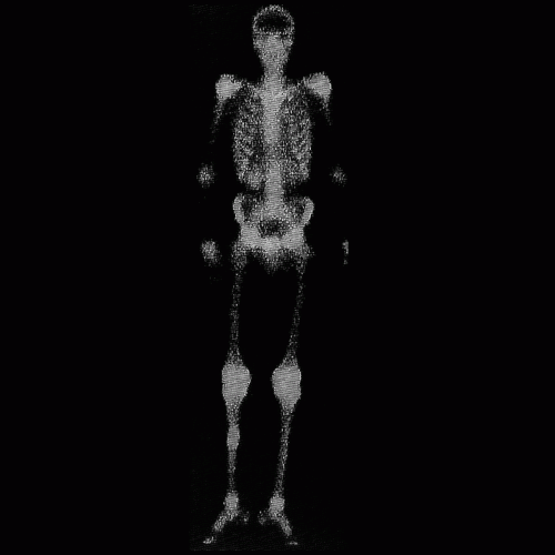 Väkären : Prison of Forgotten Names Väkären : Prison of Forgotten Names